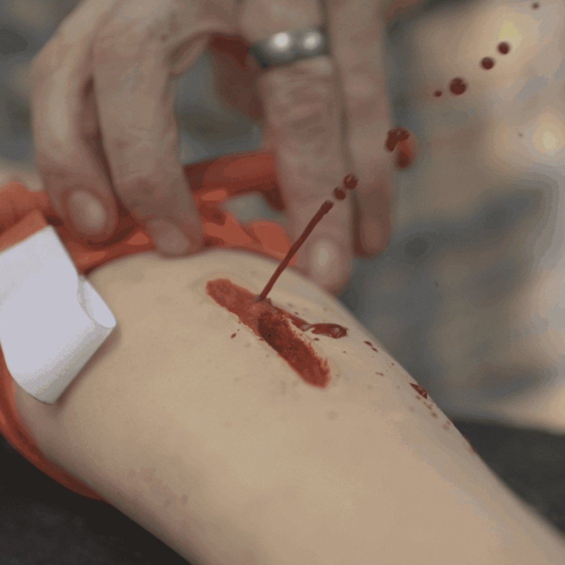 Wilderness Medical Course - Wilderness First Responder (WFR) Gray Bearded Green Beret Survival School Training Arm CAT Tourniquet Simulated Arterial Bleed