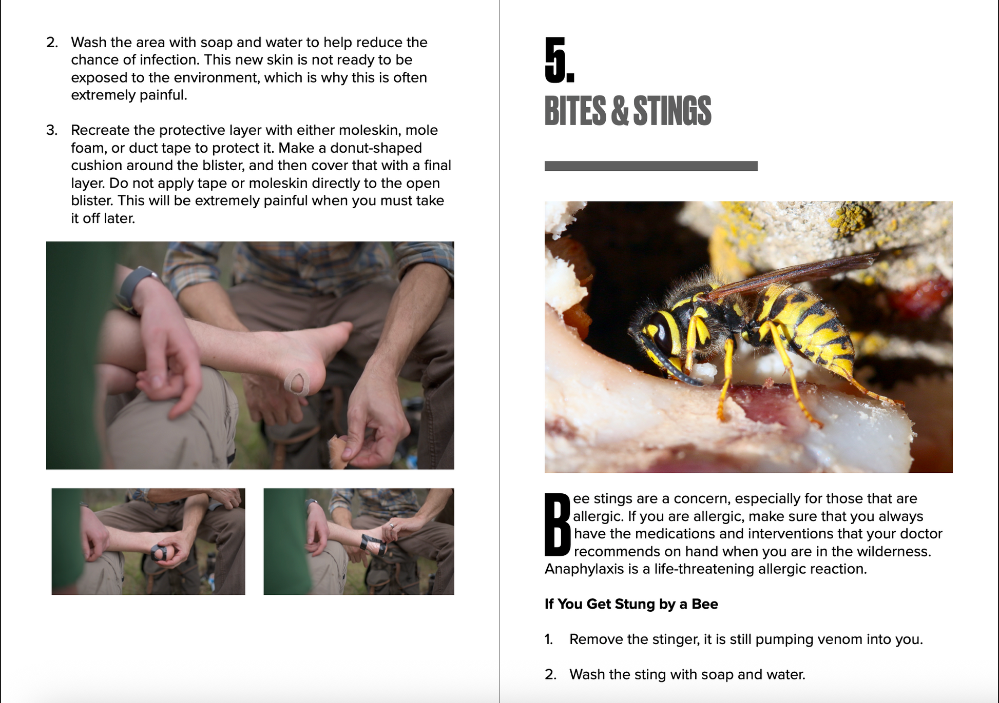 Instructional page on treating insect bites and stings with images and text.