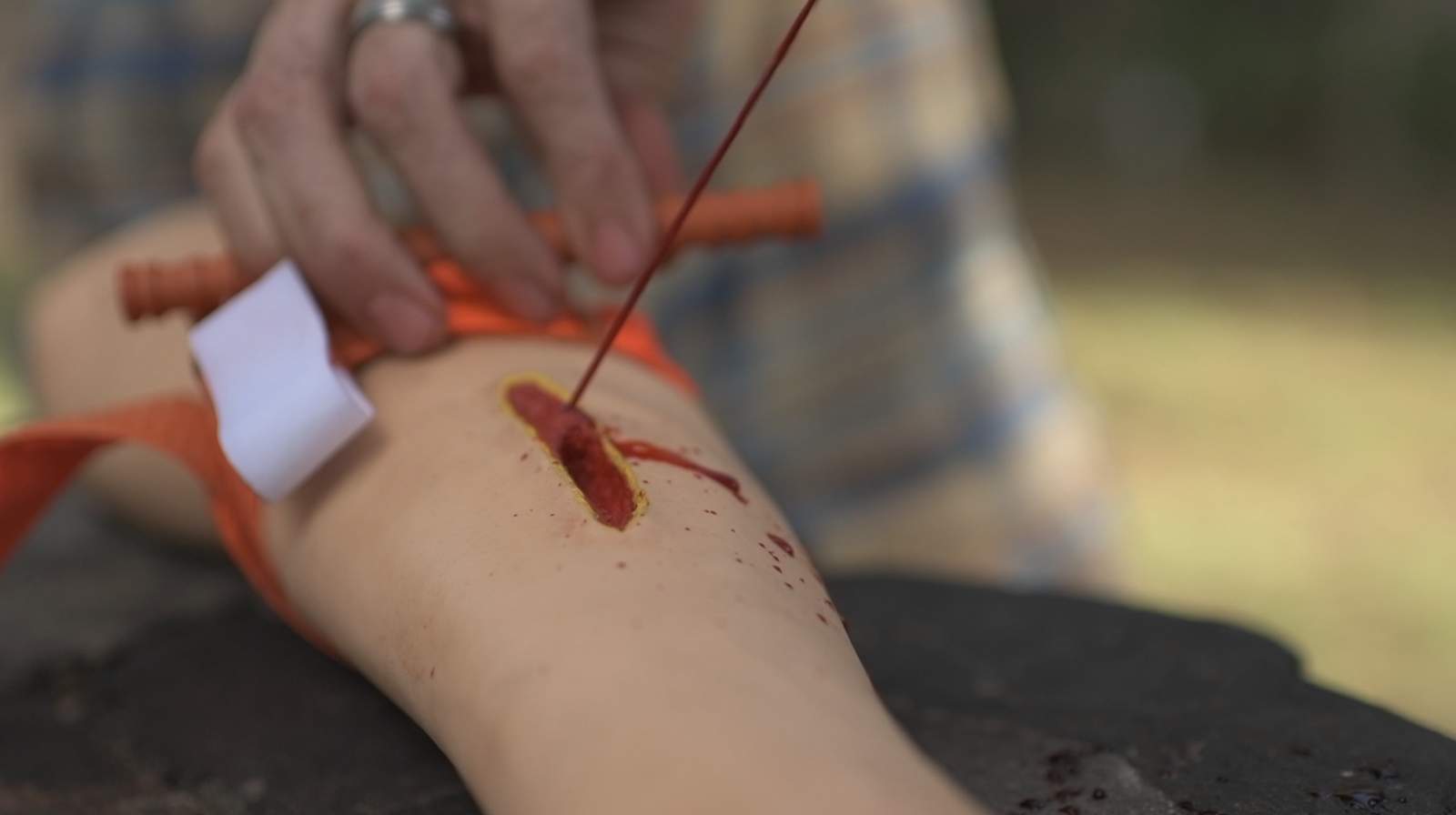 Tourniquet application on training arm during SOLO WFA bleeding control practicum
